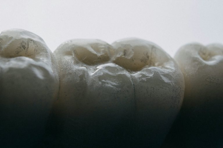 How Tooth Loss Can Damage Memory