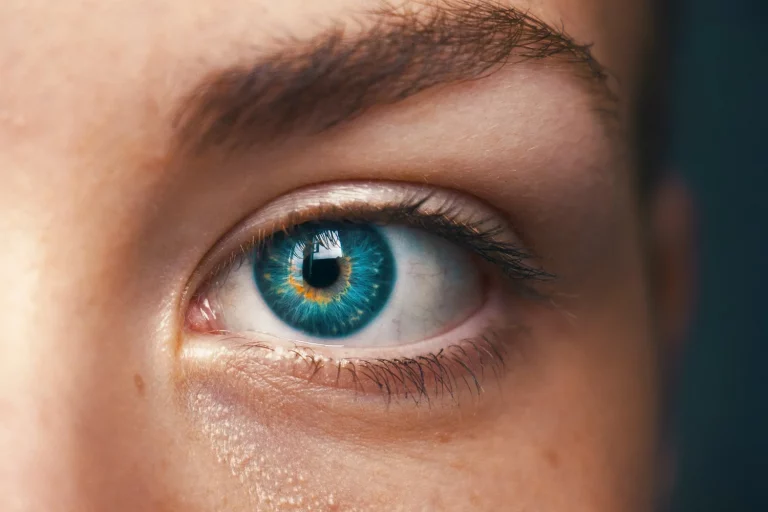 The Infraorbital Artery and the Real Risk Behind Cheek Dermal Fillers